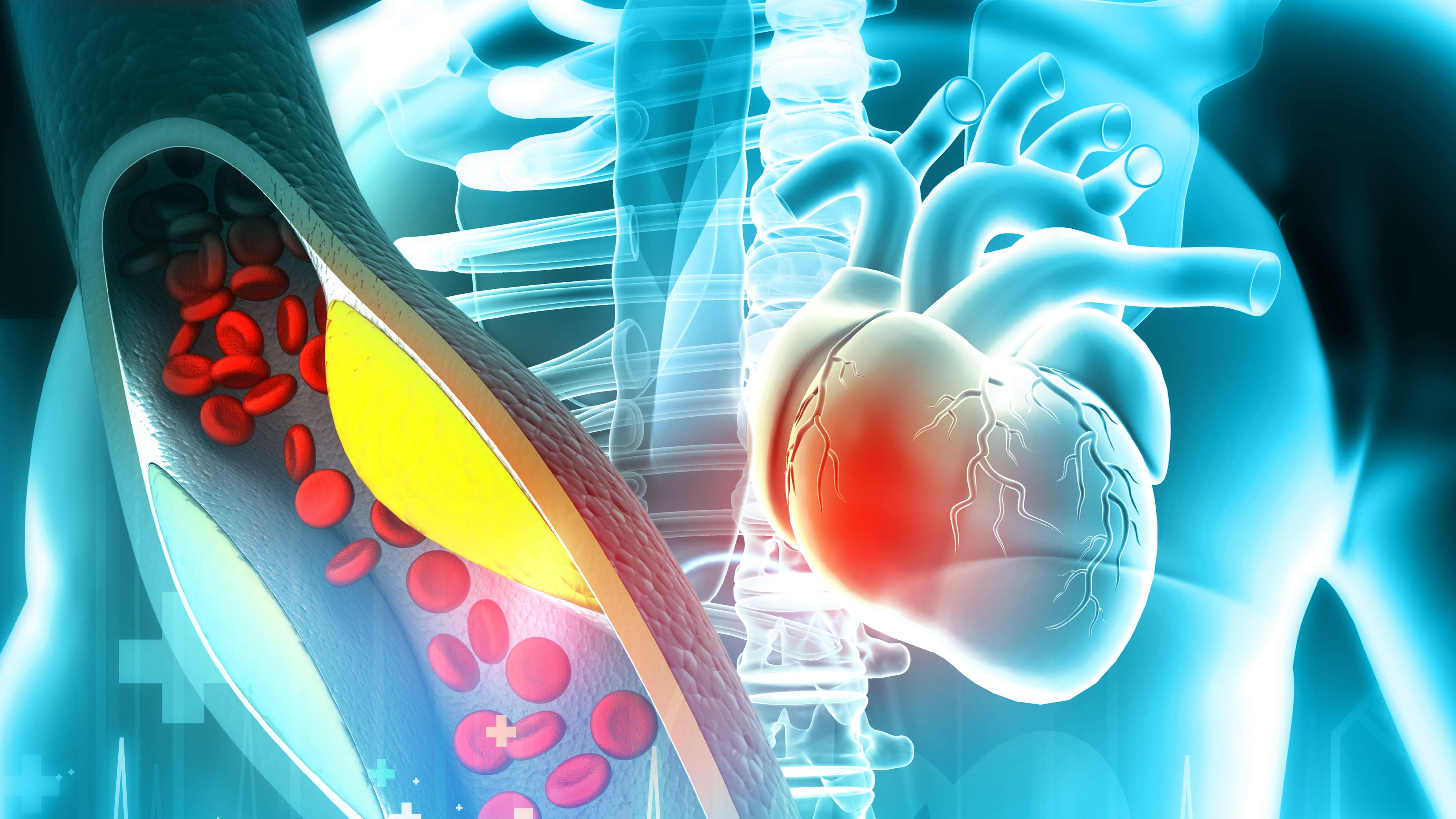 SC CholesterolCaridovascular_Image Text Split Component