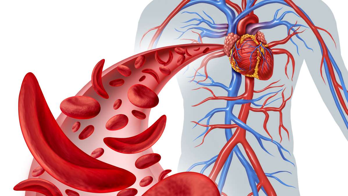 SC Sickle Cell_Image Text Split Component