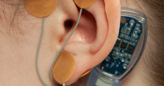 Discovery Radio - Episode #86 - Auricular Neurostimulation: Breakthrough Therapy for Kids with Functional Abdominal Pain Disorders